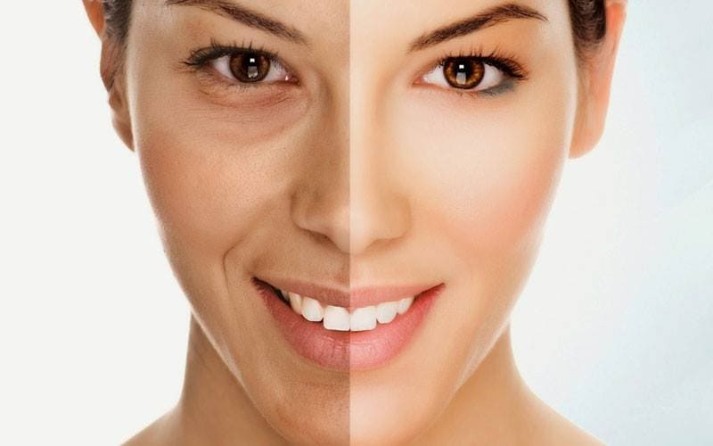 Giảm căng thẳng, làm chậm lão hóa