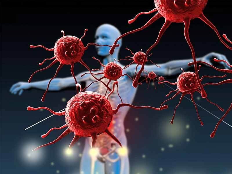 Người mắc bệnh tự miễn